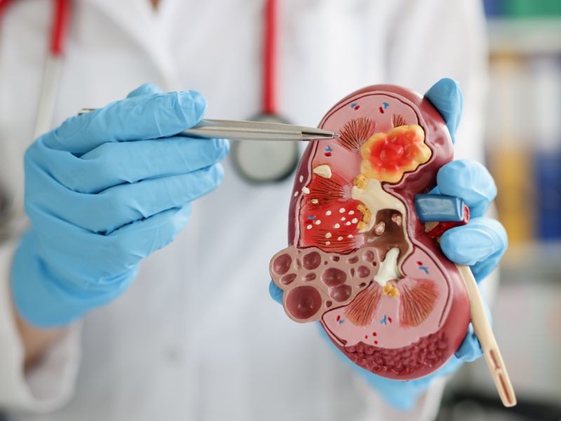 Infecção Urinária de Repetição: O Que Pode Ser e Quando Procurar um Urologista?