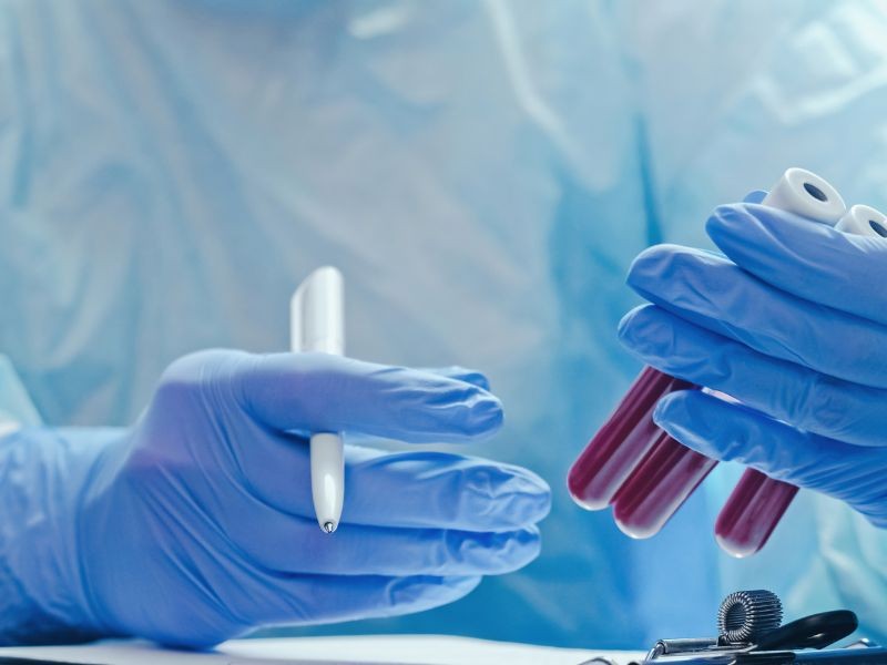 Comece 2026 com o pé direito: 5 exames de sangue para checar sua saúde agora