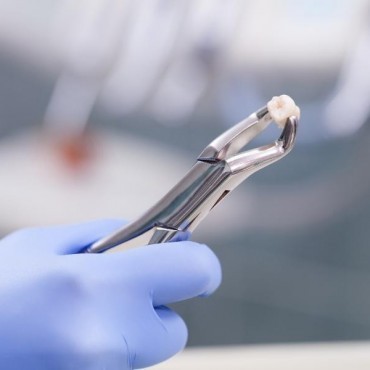 Extração Dentária em São Tomé