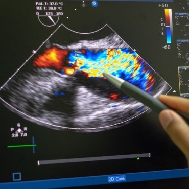 Ultrassom Morfológica do 2º Trimestre em Americano