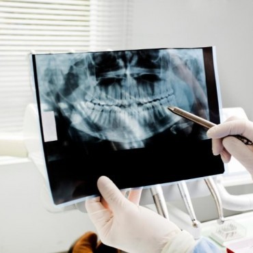 Raio-X Periapical em São Tomé