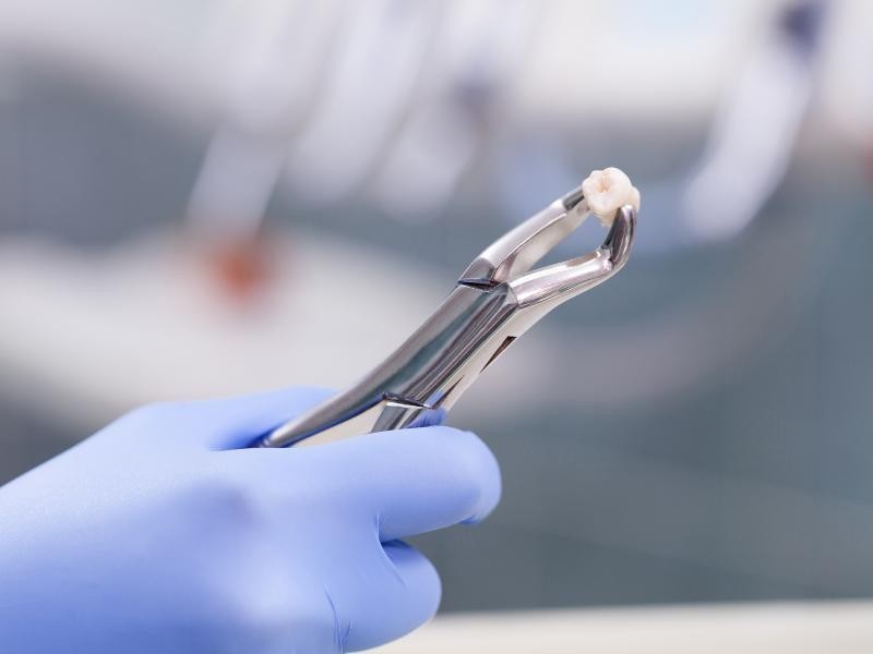 Extração Dentária